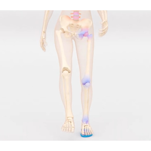 BORGinsole Patented Insole